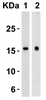 Figure 1 Western Blot Validation in Human Heart (Lane 1) and Human Prostate (Lane 2) 
Loading: 15 &#956;g of lysates per lane.
Antibodies: TSLP 4023 (4 &#956;g/mL) , 1h incubation at RT in 5% NFDM/TBST.
Secondary: Goat anti-rabbit IgG HRP conjugate at 1:10000 dilution.