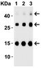 Figure 2 Western Blot Validation of TSLP with Human Recombinant protein
Loading: 30ng of TSLP partial human recombinant protein per lane. Antibodies: TSLP 4023 (Lane 1: 0.25 ug/mL, Lane 2: 0.5 ug/mL, Lane 3: 1 ug/mL) , 1h incubation at RT in 5% NFDM/TBST.
Secondary: Goat anti-rabbit IgG HRP conjugate at 1:10000 dilution.
TLSP partial human recombinant protein: 15kD, the observed bands at 30kD and 45kD are the dimer and trimer, respectively.