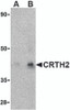 Western blot analysis of CRTH2 in human heart tissue lysate with CRTH2 antibody at (A) 1 and (B) 2 &#956;g/mL.