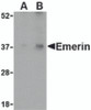 Western blot analysis of Emerin in human skeletal muscle tissue lysate with Emerin antibody at (A) 0.5 and (B) 1 &#956;g/mL.