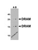 Figure 1 Western Blot Validation in Human 293 Cell Lysate
Loading: 15 &#956;g of lysate per lane.
Antibodies: DRAM 4035 (A: 1 &#956;g/mL, B: 2 &#956;g/mL) , 1h incubation at RT in 5% NFDM/TBST.
Secondary: Goat anti-rabbit IgG HRP conjugate at 1:10000 dilution.
