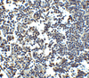 Immunohistochemistry of MDA5 in human lymph node tissue with MDA5 antibody at 2.5 ug/ml.