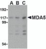 Western blot analysis of MDA5 in Daudi cell lysate with MDA5 antibody at (A) 1, (B) 2 and (C) 4 &#956;g/mL.
