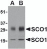 Western blot analysis of SCO1 in human brain tissue lysate with SCO1 antibody at (A) 0.5 and (B) 1 &#956;g/mL.