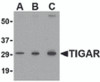 Western blot analysis of TIGAR in MCF7 cell lysate with TIGAR antibody at (A) 0.5, (B) 1 and (C) 2 &#956;g/mL.