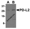 Figure 1 Western Blot Validation in Human Raji Cell Lysate
Loading: 15 &#956;g of lysates per lane.
Antibodies: PD-L2 4063 (A: 0.5 &#956;g/mL and B: 1 &#956;g/mL) , 1h incubation at RT in 5% NFDM/TBST.
Secondary: Goat anti-rabbit IgG HRP conjugate at 1:10000 dilution.
