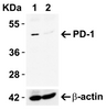 Figure 1 KO Validation in HeLa Cells 
Loading: 10 &#956;g of HeLa WT cell lysates or PD-1 KO cell lysates. Antibodies: PD-1, 4065 (4 &#956;g/mL) and beta-actin 3779 (1 &#956;g/mL) , 1 h incubation at RT in 5% NFDM/TBST.
Secondary: Goat Anti-Rabbit IgG HRP conjugate at 1:10000 dilution.