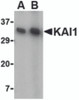 Western blot analysis of KAI1 in A549 cell lysate with KAI1 antibody at (A) 0.5 and (B) 1 &#956;g/mL.