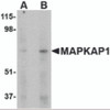 Western blot analysis of MAPKAP1 in human skeletal muscle tissue lysate with MAPKAP1 antibody at (A) 1 and (B) 2 &#956;g/mL.