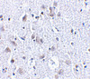 Immunohistochemistry of BRSK1 in human brain tissue with BRSK1 antibody at 2.5 ug/mL.