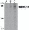 Western blot analysis of BRSK2 in human brain tissue lysate with BRSK2 antibody at (A) 0.5, (B) 1 and (C) 2 &#956;g/mL.