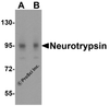 Western blot analysis of neurotrypsin in 3T3 cell lysate with neurotrypsin antibody at (A) 0.25 and (B) 0.5 &#956;g/mL.