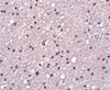 Immunohistochemistry of Neurotrypsin in human brain tissue with Neurotrypsin antibody at 2.5 ug/mL.