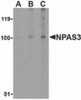 Western blot analysis of NPAS3 in rat brain tissue lysate with NPAS3 antibody at (A) 0.5, (B) 1 and (C) 2 &#956;g/mL.