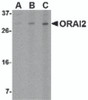 Western blot analysis of ORAI2 in Jurkat cell lysate with ORAI2 antibody at (A) 1, (B) 2 and (C) 4 &#956;g/mL.