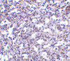 Immunohistochemistry of STIM2 in human spleen tissue with STIM2 antibody at 2.5 ug/mL.