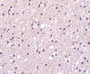 Immunohistochemistry of Presenilin1 in human brain tissue with Presenilin1 antibody at 2.5 ug/mL.