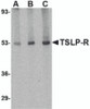 Western blot analysis of TSLP Receptor in human liver tissue lysate with TSLP Receptor antibody at (A) 0.5, (B) 1 and (C) 2 &#956;g/mL.