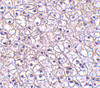 Immunohistochemistry of TSLP-R in human liver tissue with TSLP-R antibody at 5 ug/mL.