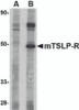 Western blot analysis of TSLP Receptor in mouse heart tissue lysate with TSLP Receptor antibody at 1 &#956;g/mL in (A) the presence and (B) the absence of blocking peptide.