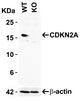 Figure 1 KO Validation of CDKN2A in 293 Cells 
Loading: 10 &#956;g of 293 WT cell lysates or CDKN2A KO cell lysates. Antibodies: CDKN2A, 4211 (2 &#956;g/mL) and beta-actin, 3779 (1 &#956;g/mL) , 1 h incubation at RT in 5% NFDM/TBST.
Secondary: Goat Anti-Rabbit IgG HRP conjugate at 1:10000 dilution.