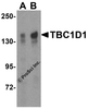 Western blot analysis of TBC1D1 expression in (A) 293 and (B) Daudi cell lysate with TBC1D1 antibody at  2 &#956;g/ml.