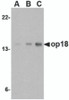 Figure 1 Western Blot Validation in Mouse EL4 Cell Lines
Loading: 15 &#956;g of lysates per lane.
Antibodies: op18 4235 (A: 0.5 µg/mL, B: 1 &#956;g /mL, C: 2 &#956;g /mL ) , 1h incubation at RT in 5% NFDM/TBST.
Secondary: Goat anti-rabbit IgG HRP conjugate at 1:10000 dilution.