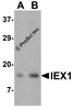 Western blot analysis of IEX-1 in mouse skin tissue lysate with IEX-1 antibody at (A) 1 and (B) 2 &#956;g/mL..