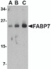Western blot analysis of FABP7 in human breast tissue lysate with FABP7 antibody at (A) 0.5, (B) 1 and (C) 2 &#956;g/mL.