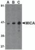 Western blot analysis of MICA in A-20 cell lysate with MICA antibody at (A) 0.5, (B) 1 and (C) 2 &#956;g/mL.