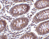 Immunohistochemistry of MICA in human colon tissue with MICA antibody at 10 ug/mL.