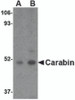 Western blot analysis of Carabin in Daudi cell lysate with Carabin antibody at (A) 1 and (B) 2 &#956;g/mL.