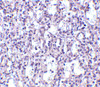 Immunohistochemistry of Carabin in human spleen tissue with Carabin antibody at 2.5 ug/mL.