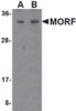 Western blot analysis of MORF4 in K562 cell lysate with MORF4 antibody at (A) 1 and (B) 2 &#956;g/mL.