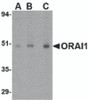 Western blot analysis of ORAI1 in human ovary tissue lysate with ORAI1 antibody at (A) 0.5, (B) 1 and (C) 2 &#956;g/mL.