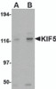 Western blot analysis of KIF5 in K562 cell lysate with KIF5 antibody at (A) 0.5 and (B) 1 &#956;g/mL.