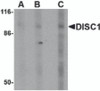 Western blot analysis of DISC1 in SK-N-SH cell lysate with DISC1 antibody at (A) 0.5, (B) 1 and (C) 2 &#956;g/mL.