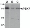 Western blot analysis of PTK7 in (A) human colon, (B) mouse kidney and (C) rat liver tissue lysate with PTK7 antibody at 1 &#956;g/mL.