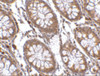 Immunohistochemistry of PTK7 in human colon tissue with PTK7 antibody at 2.5 ug/mL.