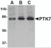 Western blot analysis of PTK7 in (A) human, (B) mouse and (C) rat colon tissue lysate with PTK7 antibody at 1 &#956;g/mL.