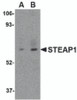Western blot analysis of STEAP1 in human spleen tissue lysate with STEAP1 antibody at (A) 1 and (B) 2 &#956;g/mL.