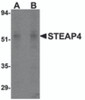 Western blot analysis of STEAP4 in rat liver tissue lysate with STEAP4 antibody at (A) 0.5 and (B) 1 &#956;g/mL.