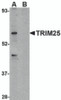 Western blot analysis of TRIM25 in HeLa cell lysate in (A) the absence and (B) presence of blocking peptide with TRIM25 antibody at 1 &#956;g/mL.