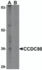 Western blot analysis of CCDC98 in human breast tissue lysate in (A) the absence and (B) presence of blocking peptide with CCDC98 antibody at 1 &#956;g/mL.