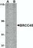 Western blot analysis of BRCC45 in HeLa cell lysate in (A) the absence and (B) presence of blocking peptide with BRCC45 antibody at 1 &#956;g/mL.