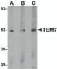 Western blot analysis of TEM7 in human liver tissue lysate with TEM7 antibody at (A) 0.5, (B) 1 and (C) 2 &#956;g/mL.