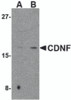 Western blot analysis of CDNF in mouse brain tissue lysate with CDNF antibody at (A) 2 and (B) 4 &#956;g/mL.