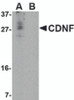 Western blot analysis of CDNF in A-20 cell lysate in (A) the absence and (B) the presence of blocking peptide with CDNF antibody at 1 &#956;g/mL.