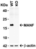 Figure 1 KO Validation in HEK293T Cells 
Loading: 10 &#956;g of HEK293T WT cell lysates or MANF KO cell lysates. Antibodies: MANF 4347 (1 &#956;g/mL) and beta-actin 3779 (1 &#956;g/mL) , 1 h incubation at RT in 5% NFDM/TBST.
Secondary: Goat Anti-Rabbit IgG HRP conjugate at 1:10000 dilution.