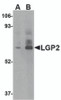 Western blot analysis of LGP2 in rat kidney tissue lysate with LGP2 antibody at (A) 1 and (B) 2 &#956;g/mL.